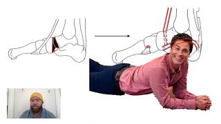 Lowman Procedure for Pes Planus [upl. by Thetes]