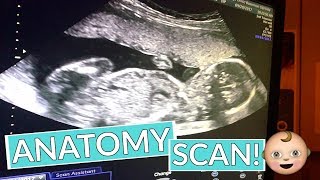 20 WEEK ANATOMY SCAN [upl. by Anirt624]