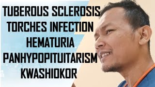 Discussion on Tuberous Sclerosis TORHES Panhypopituitarism Kwashiokor Birth Injury Hematuria [upl. by Eatnoled]