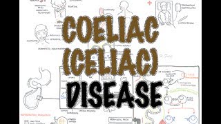 Coeliac Celiac Disease  Overview signs and symptoms pathophysiology diagnosis treatment [upl. by Theresina]