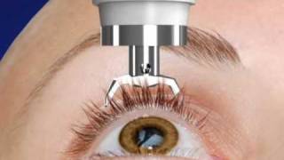 Unique DIATON Tonometry Through Eyelid  with Diaton Tonometer  Introduction  Description Part1 [upl. by Sakram]