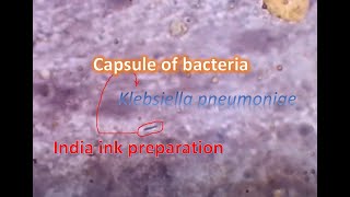 India ink preparation showing capsule of bacteria [upl. by Janna]