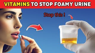 Top 3 Vitamins That Help Stop Proteinuria and Heal Your Kidneys  Kidney Stones [upl. by Eniamrej421]