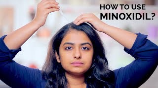 How To Use Minoxidil  Hair Regrowth  Skin Diaries [upl. by Adnolrehs219]