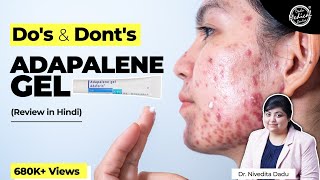 Adapalene Gel Review  Adapalene Gel 01  How to Use Adapalene Gel 01  Dr Nivedita Dadu [upl. by Naik528]