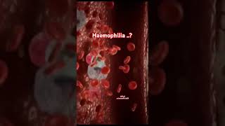 ABOUT HAEMOPHILIA ।। SYMPTOMS OF HAEMOPHILIA।। TREATMENT।।haemophilia shortstrendingytmedical [upl. by Rainie]