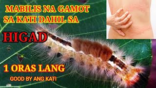 MABILIS NA GAMOT SA KATI DAHIL SA HIGAD [upl. by Judsen]