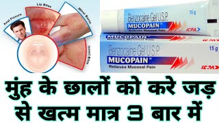 MUCOPAIN GEL REVIEW IN HINDI  HOW TO USE OF MUCOPAIN GEL CREAM [upl. by Junie]