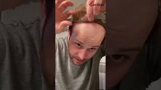 Breaking Down Hair System Installation for You  Lordhair Men‘s Hairpieces [upl. by Nennerb]