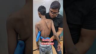 Scoliosis treatment drrajneeshkant worldfamousChiropractor [upl. by Rabaj]