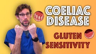 Coeliac Disease Explained  Gluten Sensitivity  A to Z of the NHS  Dr Gill [upl. by Allegna]