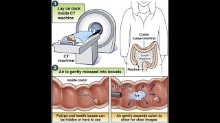 CT Colonography CT scan abdomen [upl. by Nnaaihtnyc]