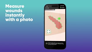 Introducing Healicos MEASURE  Measure wounds instantly with a photo [upl. by Llehsyar]
