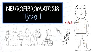 What is Neurofibromatosis Type 1 NF1 [upl. by Aratehs]