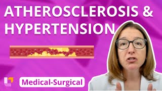 Atherosclerosis and Hypertension  MedicalSurgical  Cardiovascular System  LevelUpRN [upl. by Llenrag]