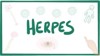 Herpes oral amp genital  causes symptoms diagnosis treatment pathology [upl. by Kerman]