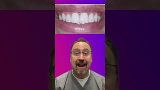 Is Baking Soda Good For Your Teeth [upl. by Ecad]