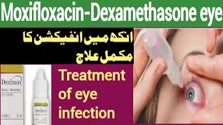 Moxifloxacin and Dexamethasone eye drops  eye infection treatment  moxicip eye drop deximox eye d [upl. by Duck]