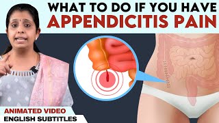 Appendicitis pain  Permanent relief  அப்பெண்டிசிடிஸ்க்கு அறுவை சிகிச்சை தான் தீர்வா [upl. by Tomlinson]