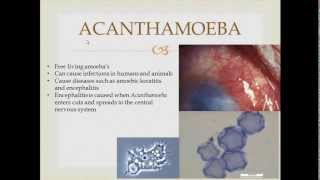 Parasitology Acanthamoeba [upl. by Niabi]