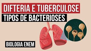 DIFTERIA E TUBERCULOSE tipos de bacterioses  Biologia para o Enem  Cláudia de Souza Aguiar [upl. by Ileyan21]