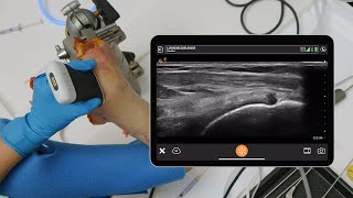 Supraspinatus and Subacromial Injections [upl. by Udela]