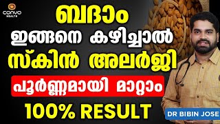 താരൻ പെട്ടെന്ന് മാറും ഇങ്ങനെ ചെയ്താൽ  Dandruff Treatment at Home  DrRadhika SBhat [upl. by Aivatnwahs203]