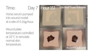 Foam Dressing Comparison  ALLEVYN Adhesive vs ActivHealTM Adhesive [upl. by Ducan]