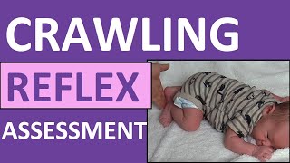 Crawling Reflex Assessment Infant  Newborn  Bauer Reflex  Pediatric Nursing NCLEX [upl. by Antoni859]