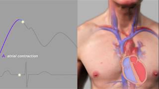 Easy Measurement of Jugular Venous Pressure [upl. by Aryam]