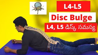 L4L5 Disc Bulge exercises  Sciatica relief herniated disc exercises L4L5 [upl. by Aramac]