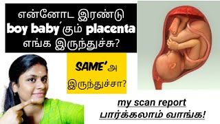 gender prediction during pregnancy in tamil  how to find baby boy or girl in scan report in tamil [upl. by Eatnhoj47]