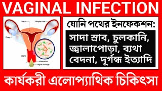 Vaginal infection treatment in banglaVaginal yeast infection treatmentVaginal fungal infection [upl. by Gualtiero469]