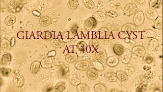 Giardia lamblia cyst under microscope at 40X [upl. by Hollis193]