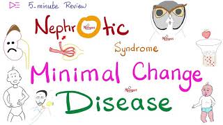 Minimal Change Disease  Nephrotic Syndrome  🖐 5Minute Review [upl. by Fife]