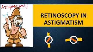 RETINOSCOPY in ASTIGMATISM  Break intensity  brightness and skew  Straddling [upl. by Ordnassela]