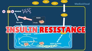 Insulin Resistance Part 2 Basal Lipolysis Free Fatty Acids and Randle cycle Hypothesis [upl. by Russon]