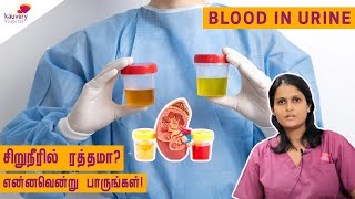 Blood in Urine [upl. by Parthen]