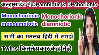 Monochorionic Diamniotic amp Dichorionic Diamniotic Twins Ultrasound Scan  Pregnancy USG shorts [upl. by Lazar800]