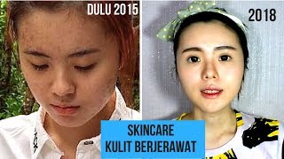 skincare routine amp skincare review muka berjerawat INDO 2018  get unready with me [upl. by Navy]