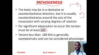 Volvulussigmoidcecaltransverse colonsplenic flexture part I by dr Tadesse fenta [upl. by Ahsiam]