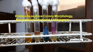 Klebsiella oxytoca colony morphology and Biochemical Tests [upl. by Eirollam]