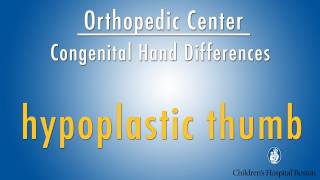 hypoplastic thumb  congenital hand differences  Boston Childrens Hospital [upl. by Aynuat]