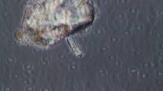 Vaginicola  fish tank water sample  Protozoans and other small critters [upl. by Vani655]