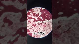 Expired lipstick under the microscope youtubeshorts easypharma [upl. by Elroy]