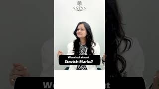 Causes of Stretch Marks  How to Treat Them  Skin Treatment  Satya Skin Clinic [upl. by Amol221]