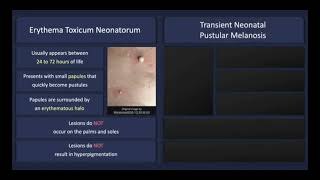 Transient neonatal pustulosis vs erythema toxicum neonatorum Dermatosis of infancy dermatology [upl. by Pickar]