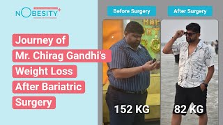 From Overweight Challenges to Positive Recognition Mr Chirag Gandhis Life After Bariatric Surgery [upl. by Enirehtac]