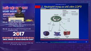 Báo cáo Nền viêm trong COPD và vai trò của ICS LABA trong điều trị COPD [upl. by Onilegna]