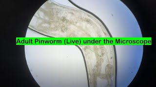 Adult Pinworm Microscopy [upl. by Lorilee]